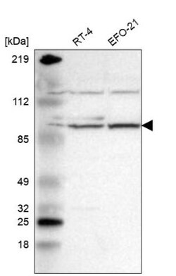 RPGR Antibody, Novus Biologicals 0.1mL; Unlabeled:Antibodies, Polyclonal